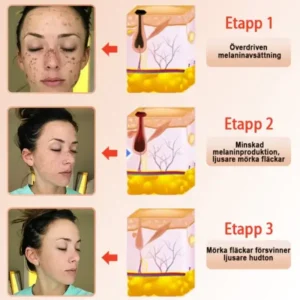 Jorondy® Purifying Peeling Gel
