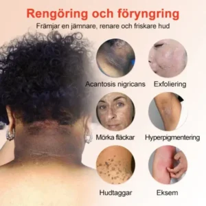 Jorondy® Purifying Peeling Gel