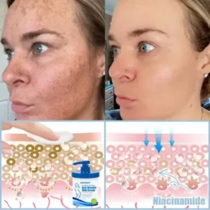 Jorondy® Anti-Wrinkle Skin Cream