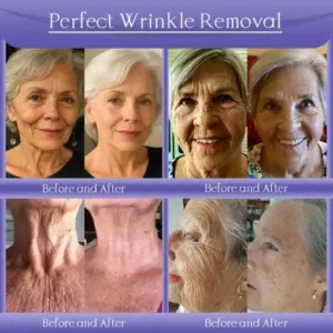 Jorondy® Skin Firming & Anti-Wrinkle Cream