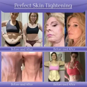 Jorondy® Skin Firming & Anti-Wrinkle Cream