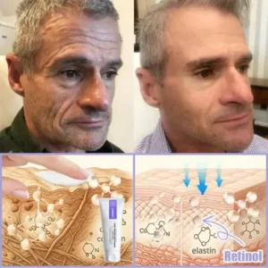 Jorondy® Skin Firming & Anti-Wrinkle Cream