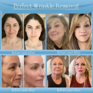 𝐉𝐨𝐫𝐨𝐧𝐝𝐲® Age-Defying Lifting Serum – Remove Wrinkles, Firms Skin, Whitening