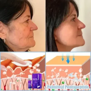 𝐉𝐨𝐫𝐨𝐧𝐝𝐲® Age-Defying Lifting Serum – Remove Wrinkles, Firms Skin, Whitening