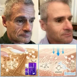 𝐉𝐨𝐫𝐨𝐧𝐝𝐲® Age-Defying Lifting Serum – Remove Wrinkles, Firms Skin, Whitening