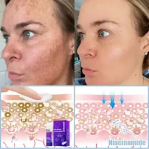 𝐉𝐨𝐫𝐨𝐧𝐝𝐲® Age-Defying Lifting Serum – Remove Wrinkles, Firms Skin, Whitening