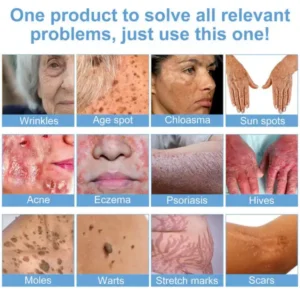 𝗝𝗼𝗿𝗼𝗻𝗱𝘆® Bee Bright Multi-Symptom Skin Treatment Cream