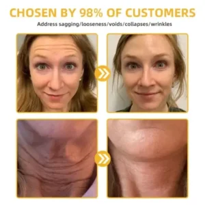 𝐉𝐨𝐫𝐨𝐧𝐝𝐲® BeeTight Anti-Aging Pro-Lifting Cream