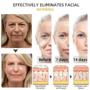 𝐉𝐨𝐫𝐨𝐧𝐝𝐲® BeeTight Anti-Aging Pro-Lifting Cream