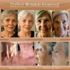 𝐉𝐨𝐫𝐨𝐧𝐝𝐲® F-LIFT Anti-Wrinkle Firming Cream