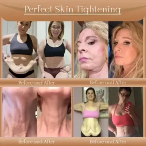𝐉𝐨𝐫𝐨𝐧𝐝𝐲® F-LIFT Anti-Wrinkle Firming Cream