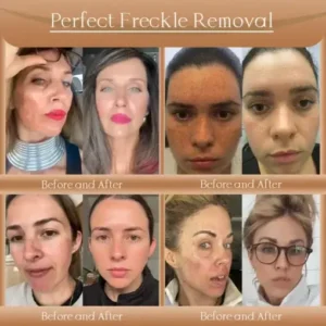 𝐉𝐨𝐫𝐨𝐧𝐝𝐲® F-LIFT Anti-Wrinkle Firming Cream