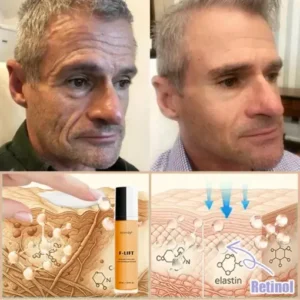 𝐉𝐨𝐫𝐨𝐧𝐝𝐲® F-LIFT Anti-Wrinkle Firming Cream