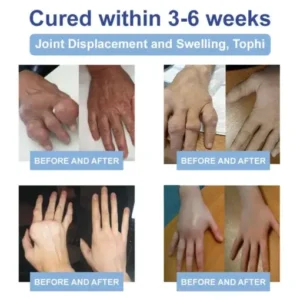 𝐉𝐨𝐫𝐨𝐧𝐝𝐲® Magnesium Pain Relief & Bone Healing Cream