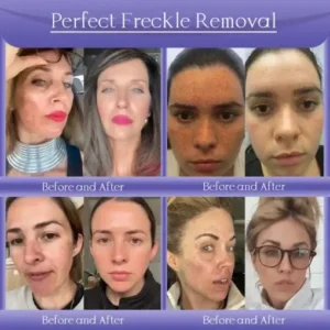 𝐉𝐨𝐫𝐨𝐧𝐝𝐲® NATURA-LIFT Overnight Wrinkle Recovery Cream