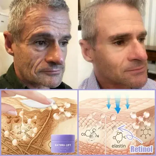 𝐉𝐨𝐫𝐨𝐧𝐝𝐲® NATURA-LIFT Overnight Wrinkle Recovery Cream