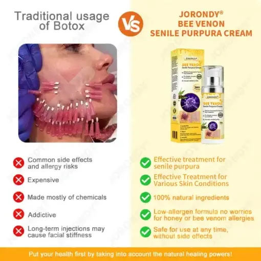 JORONDY® Bee Venom Senile Purpura Cream