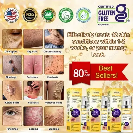 JORONDY® Bee Venom Senile Purpura Cream