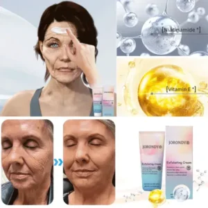 JORONDY® Exfoliating Cream for Dark Spots & Firmer Skin