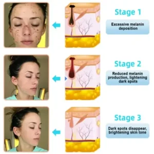 JORONDY® Exfoliating Cream for Dark Spots & Firmer Skin