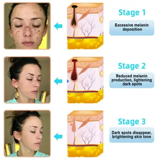 JORONDY® Exfoliating Cream for Dark Spots & Firmer Skin