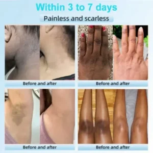 JORONDY® Exfoliating Cream for Dark Spots & Firmer Skin