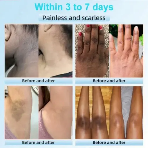 JORONDY® Exfoliating Cream for Dark Spots & Firmer Skin