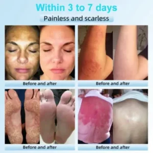 JORONDY® Exfoliating Cream for Dark Spots & Firmer Skin