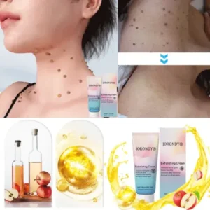 JORONDY® Exfoliating Cream for Dark Spots & Firmer Skin