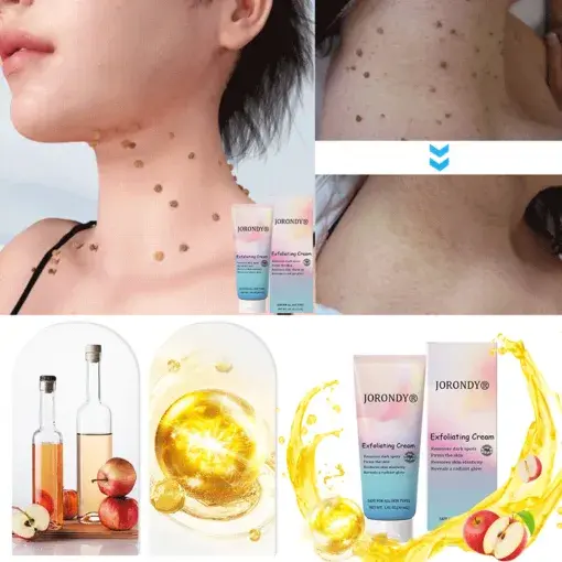 JORONDY® Exfoliating Cream for Dark Spots & Firmer Skin