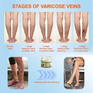 JORONDY® Horse Chestnut Vein Cream