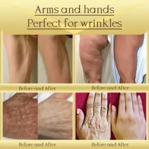 Jorondy® AH-8 Skin Firming Cream