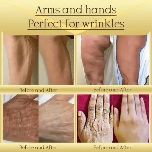 Jorondy® AH-8 Skin Firming Cream