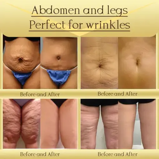 Jorondy® AH-8 Skin Firming Cream