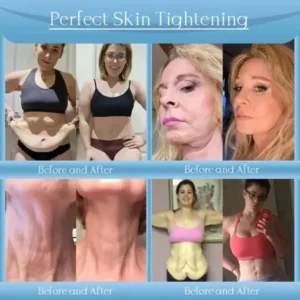 Jorondy® Anti-Falten-Creme zur Faltenreduzierung, Hautstraffung und Aufhellung