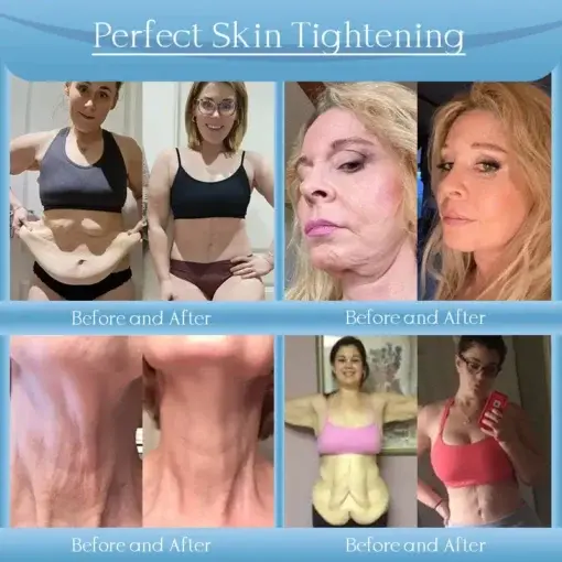 Jorondy® Anti-Falten-Creme zur Faltenreduzierung, Hautstraffung und Aufhellung