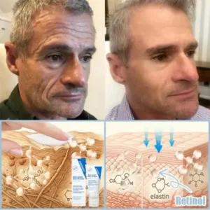 Jorondy® Anti-Falten-Creme zur Faltenreduzierung, Hautstraffung und Aufhellung