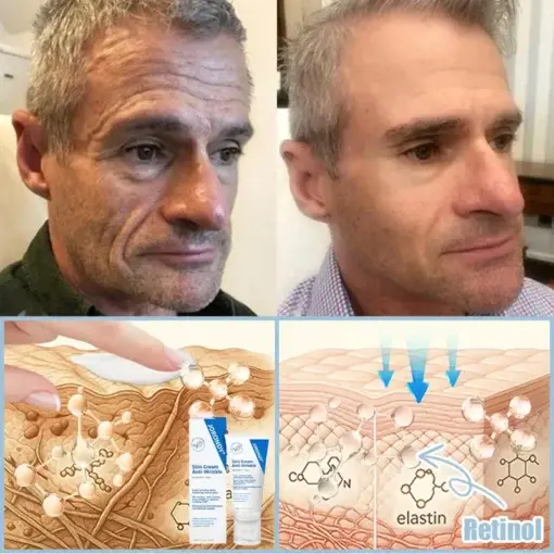 Jorondy® Anti-Falten-Creme zur Faltenreduzierung, Hautstraffung und Aufhellung