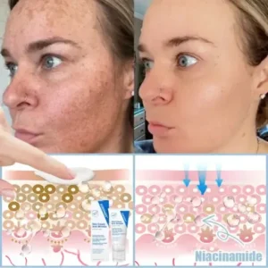 Jorondy® Anti-Falten-Creme zur Faltenreduzierung, Hautstraffung und Aufhellung