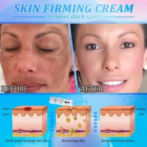 Jorondy® Anti-Glycation Firming Cream