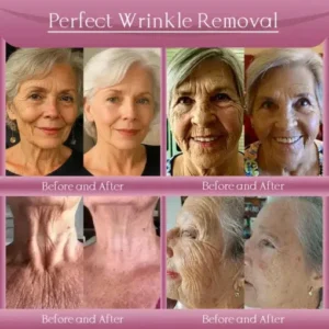 Jorondy® Anti-Wrinkle Skin Cream for Remove Wrinkles