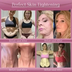 Jorondy® Anti-Wrinkle Skin Cream for Remove Wrinkles