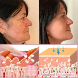 Jorondy® Anti-Wrinkle Skin Cream for Remove Wrinkles