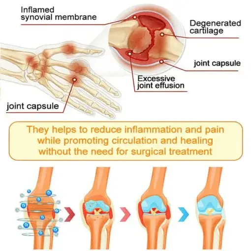 Jorondy® Bee Venom Pain-Relief Bone Healing Spray