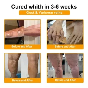 Jorondy® Bee Venom Pain-Relief Bone Healing Spray