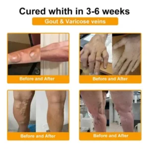 Jorondy® Bee Venom Pain-Relief Bone Healing Spray