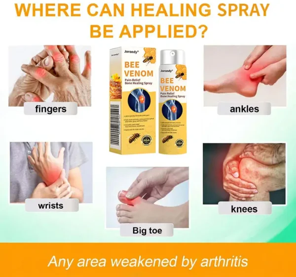 Jorondy® Bee Venom Pain-Relief Bone Healing Spray🐝🐝(Specially for older adults & AAOS recommends)