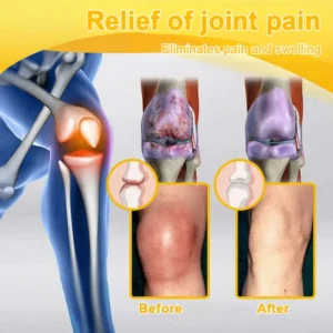 Jorondy® Bee Venom Pain-Relief Bone Healing Spray🐝🐝(Specially for older adults & AAOS recommends)