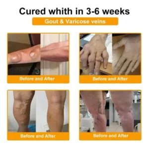 Jorondy® Bee Venom Pain-Relief Bone Healing roll-on-On