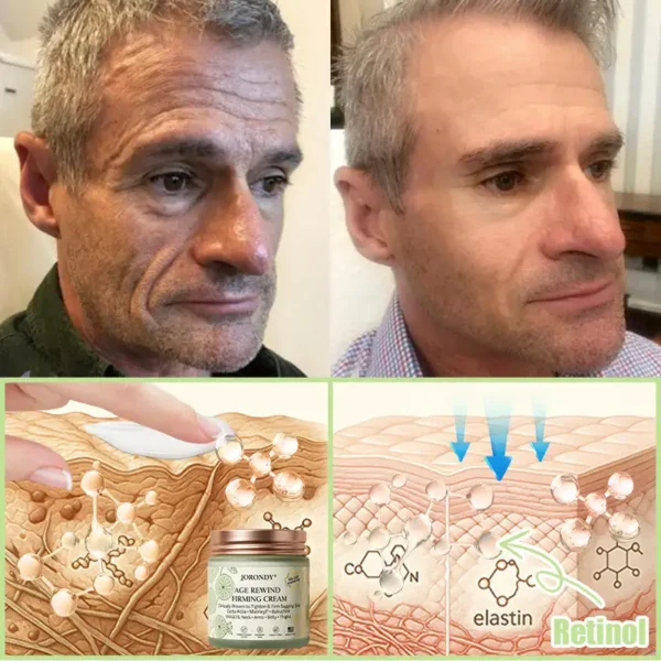 Jorondy® Firming Cream——Visibly Firms in Just 21 Days – Without Surgery or Irritation